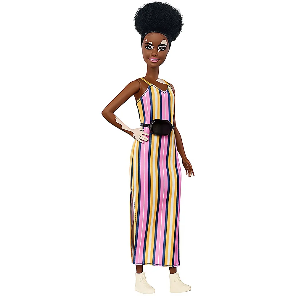 Barbie Fashionistas Puppe Vitiligo mit Streifenkleid Nr.135